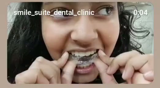 Orthodontic smile care at Smile Suite Dental Clinic